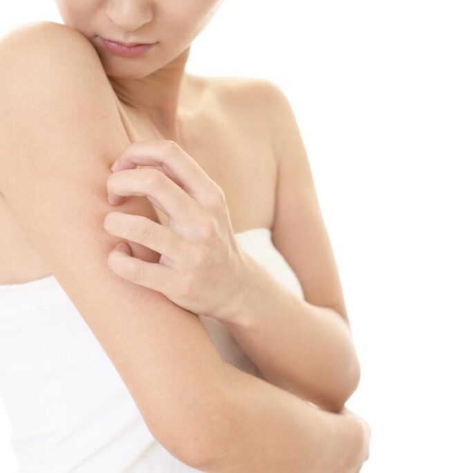 Winter Skin Dermatitis, Blog Dalu Natural Skincare