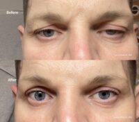 Eye Patch Eye Mask Dalu natural skincare