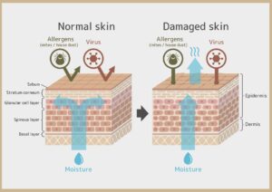 skin_barrier_skin_structure_dalu